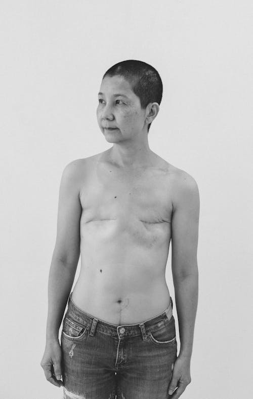 Black and white of serious topless mature ethnic female in jeans standing and looking away with scars on chest after breast removal surgery from cancer in studio on gray background