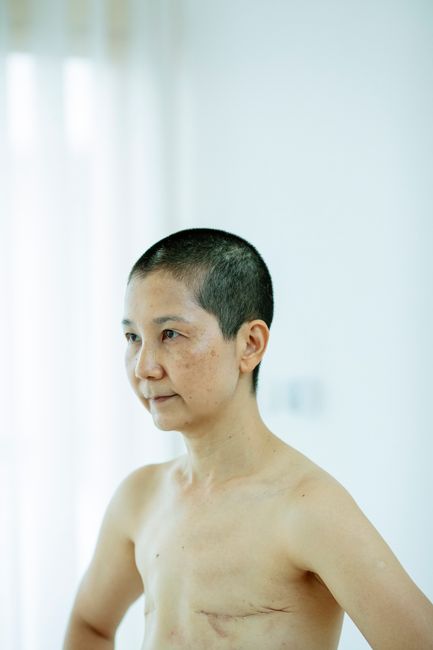 라디오스타에서 처음 꺼낸 수술 이야기