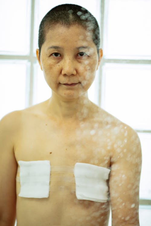 Senior Asian woman with bandages on breast after surgery looking at camera