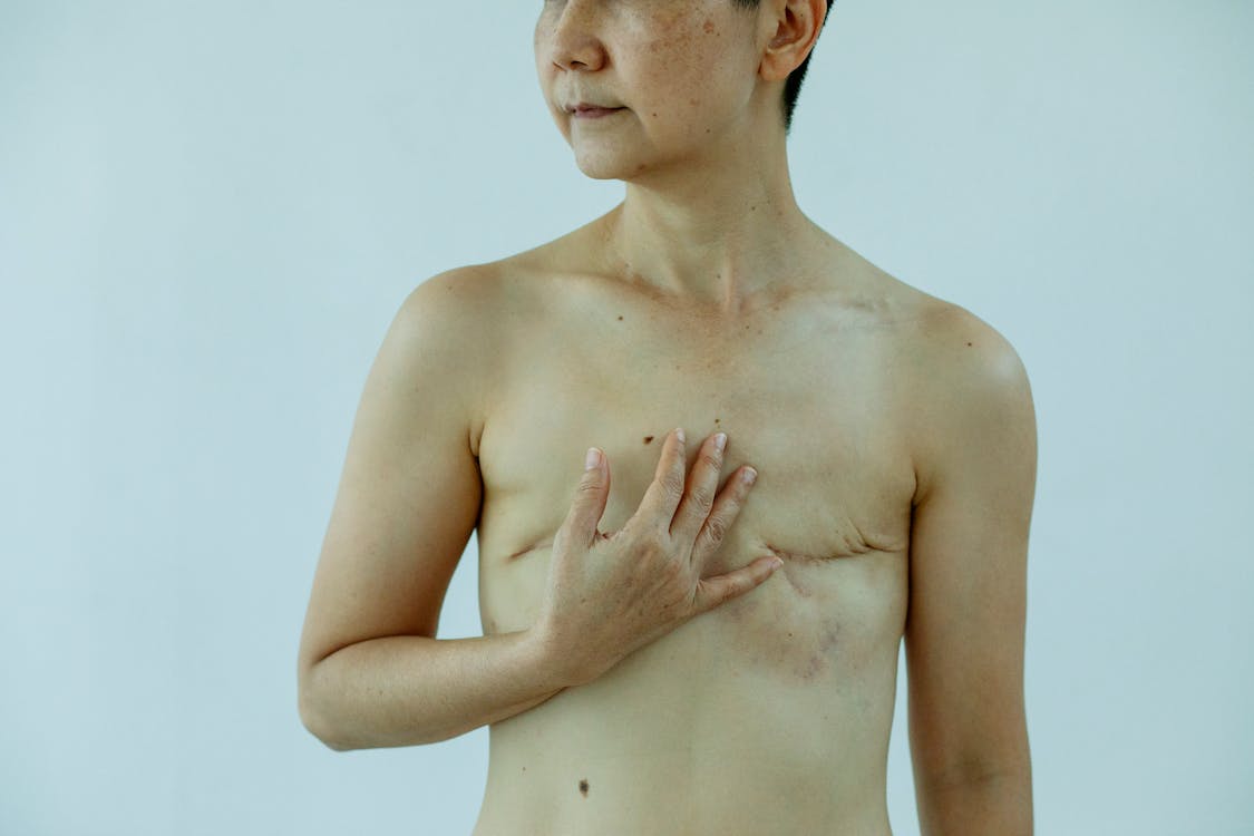 Crop anonymous female touching breast with scars after operation on white background of studio