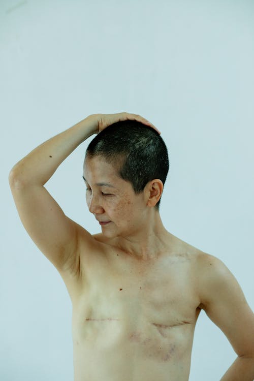 Shirtless Asian woman with breast cancer and scars · Free Stock Photo
