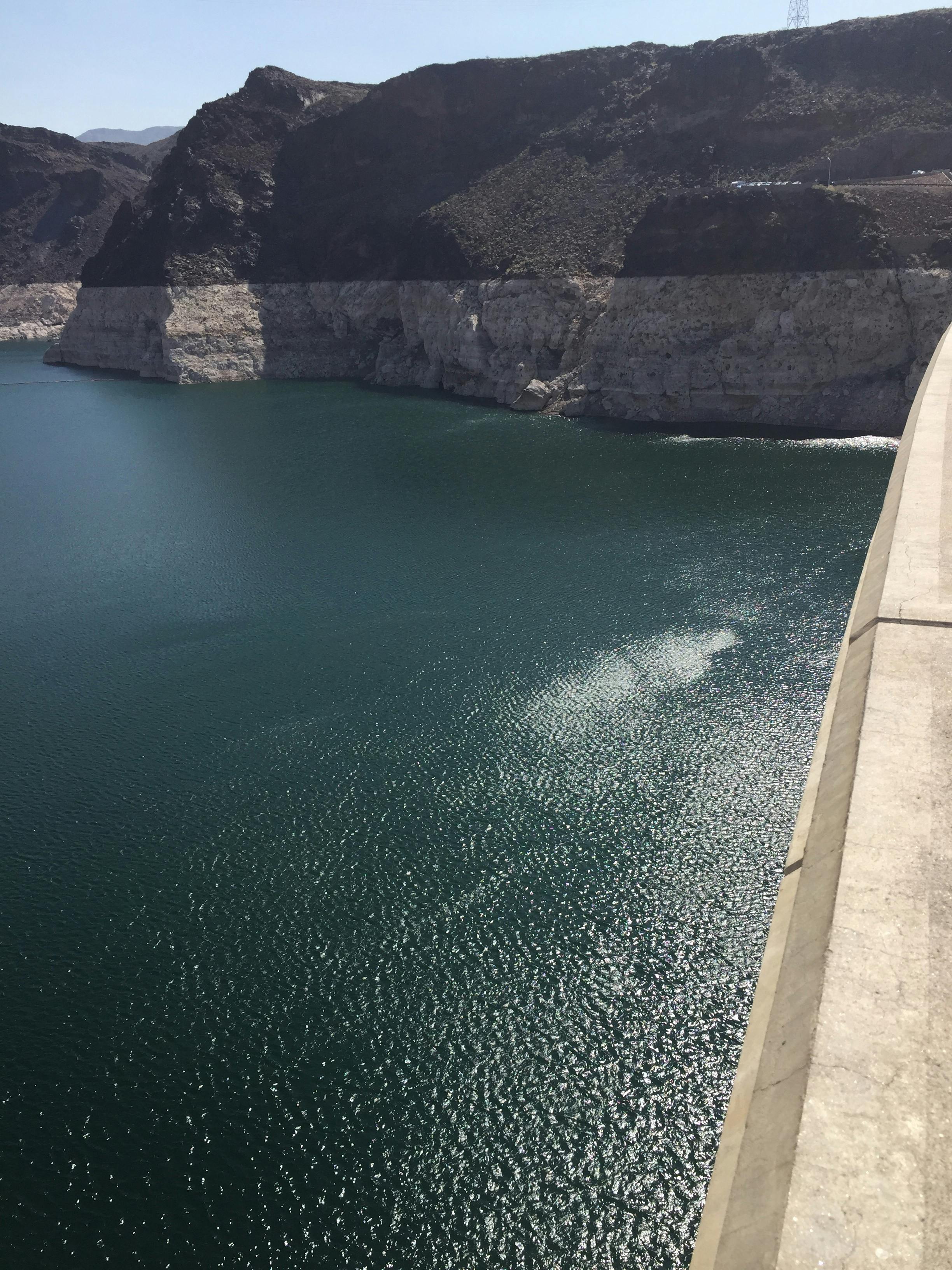 Dermal Filler Application