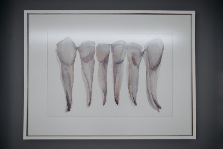 Framed Painting Of Extracted Teeth On A Wall