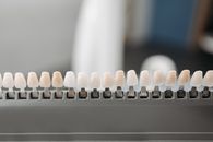 Different Shades of Veneers