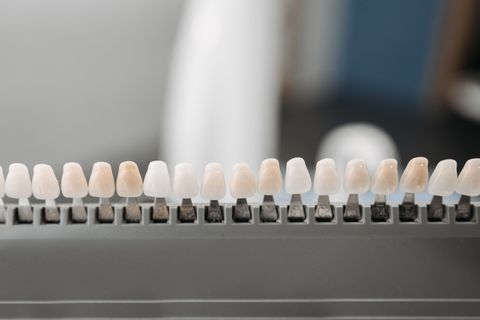 Cosmetische Tandheelkunde