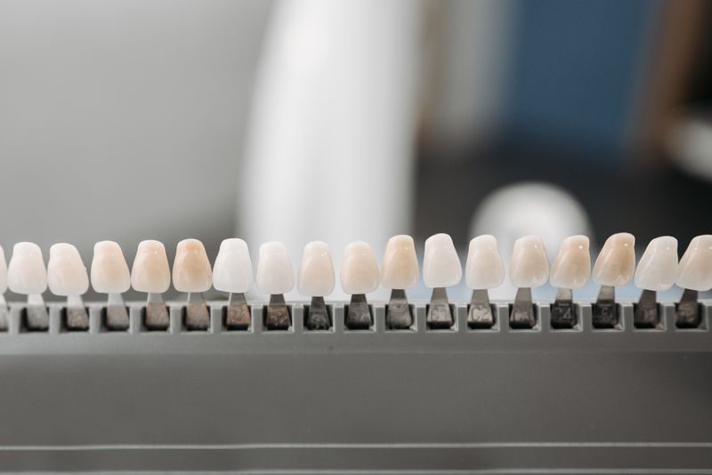 Veneers and Bonding