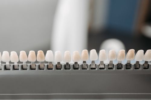 Contorneado Dental