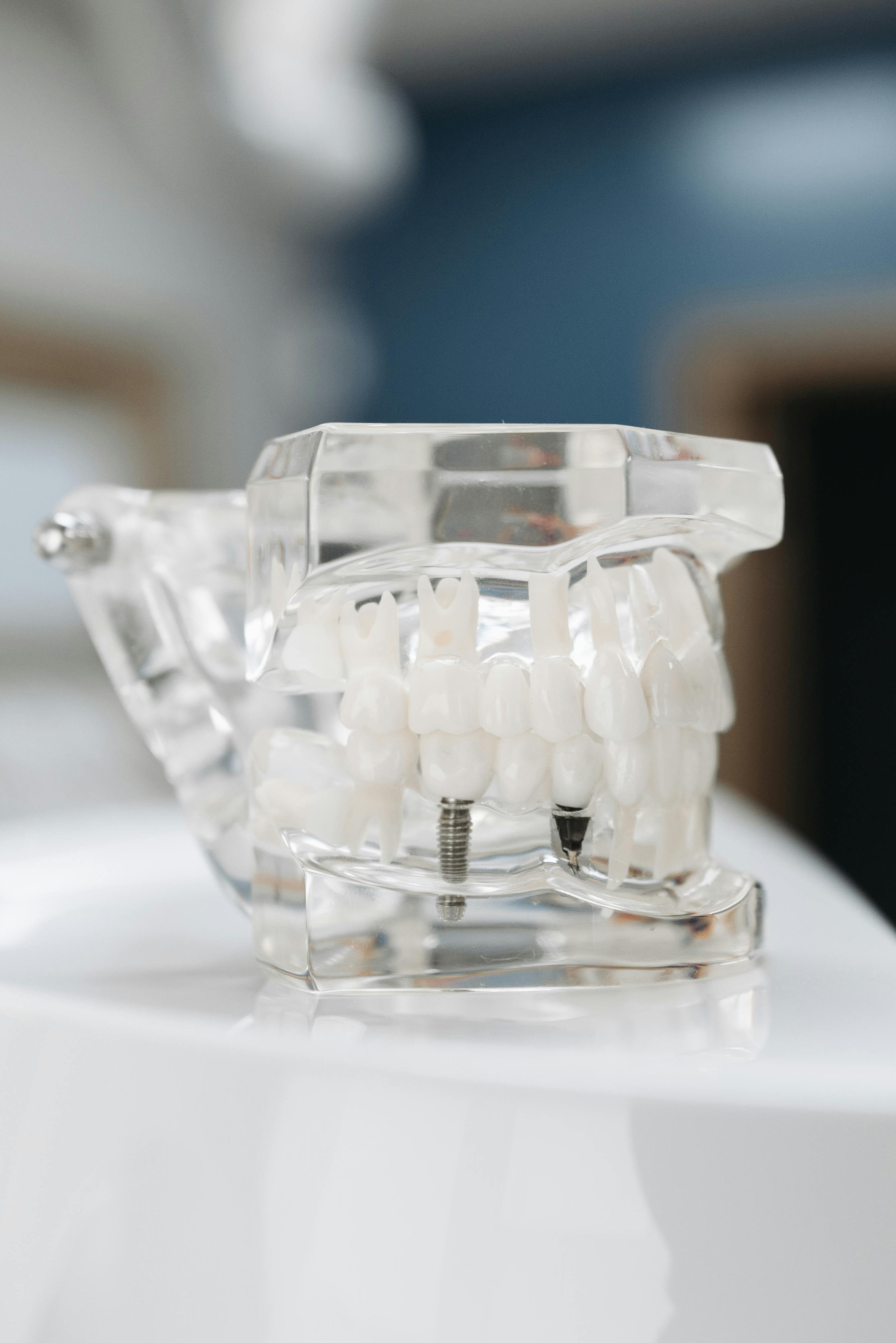 custom dental crowns for implants in Johnstown