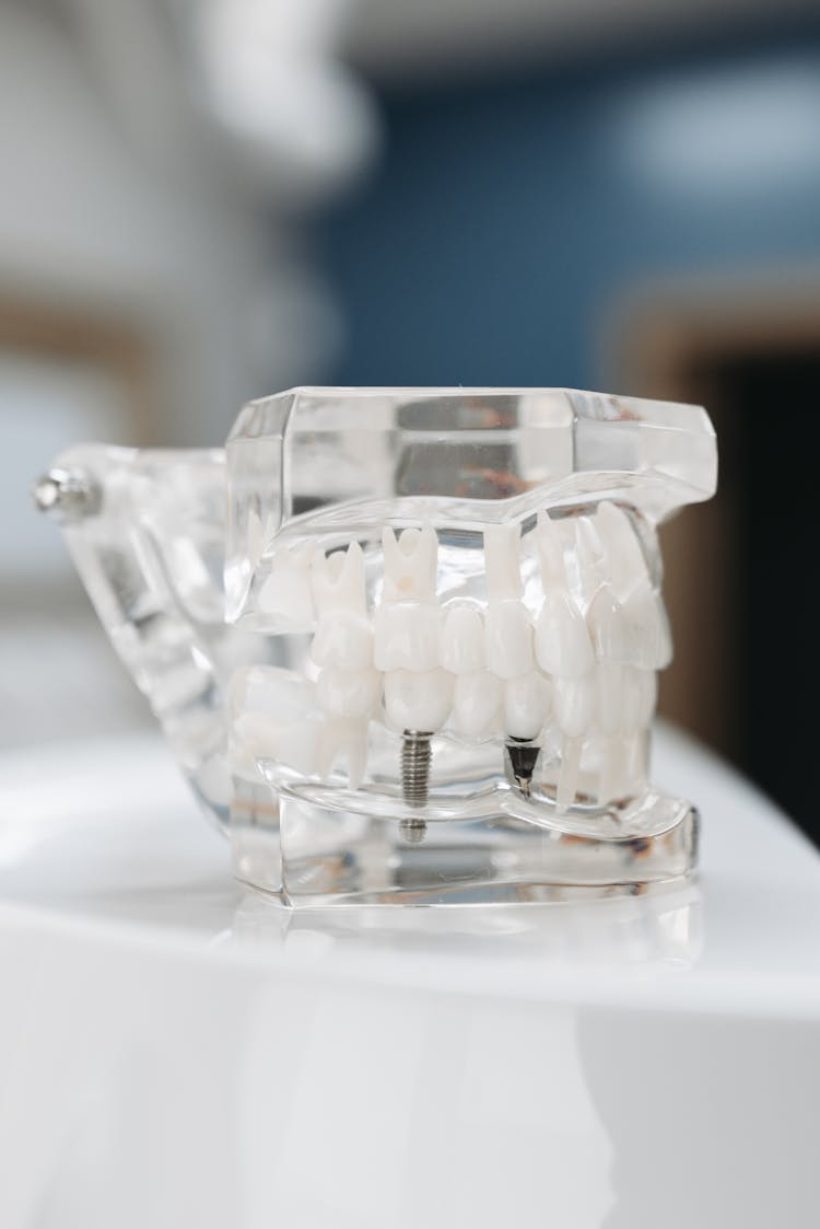 Transparent Dental Implant Model