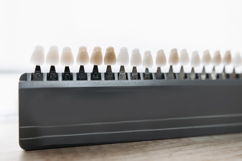 Ceramic veneer and tooth shade samples arranged for colour comparison