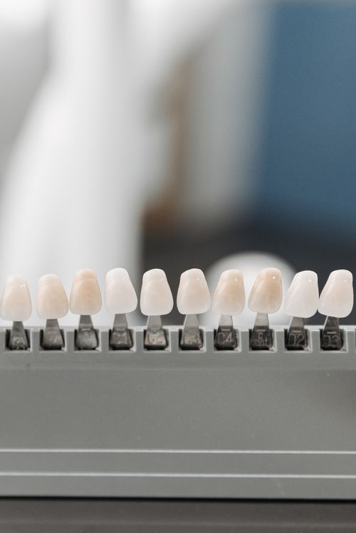 Free Close-up display of dental veneer samples in a holder, ideal for dentistry. Stock Photo