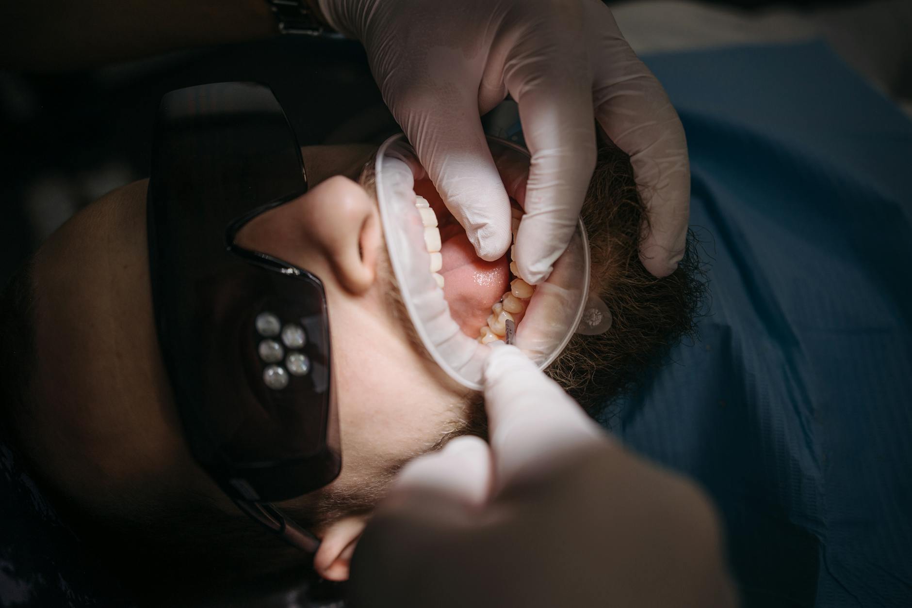 A dentist's hands examining a patient's teeth using specialized tools.
