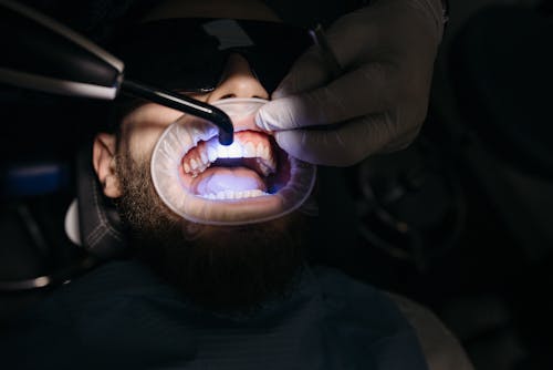 A Man Getting Ultraviolet Treatment for His Teeth