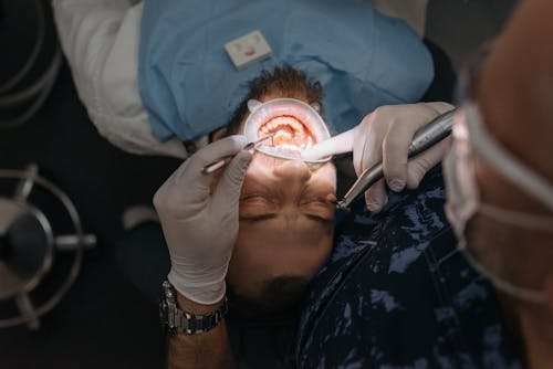 Free Man Getting a Dental Check Up Stock Photo