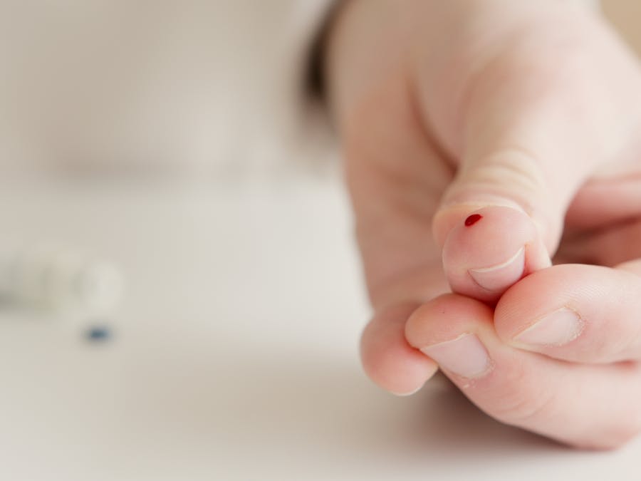 What to do before a blood test to make it easier?
