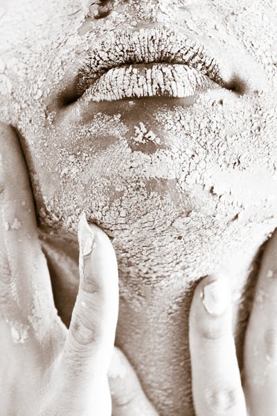Dry skin image 1