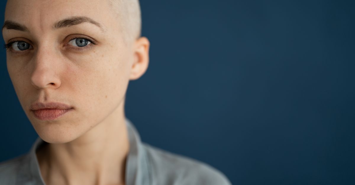 Preoperative Chemo-Immunotherapy Shows Promise in Head, Neck Cancer