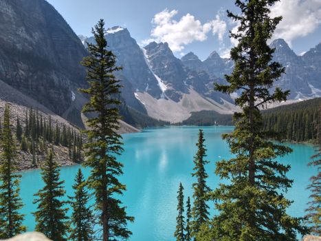 Tranquil view of Moraine Lake surrounded by lush pine forests and majestic rocky mountains.