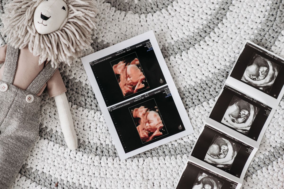 Échographie pelvienne : déroulement et préparation - Déroulement d’une échographie par voie endovaginale ou endorectale