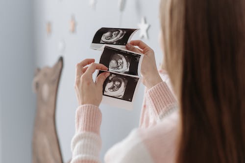 Бесплатное стоковое фото с беременная женщина, беременность, женщина