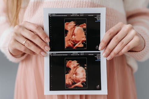 免费 医学扫描, 圖片, 孕婦 的 免费素材图片 素材图片