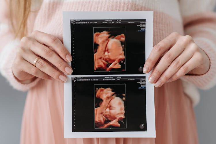 A Pregnant Woman Holding An Ultrasound Picture