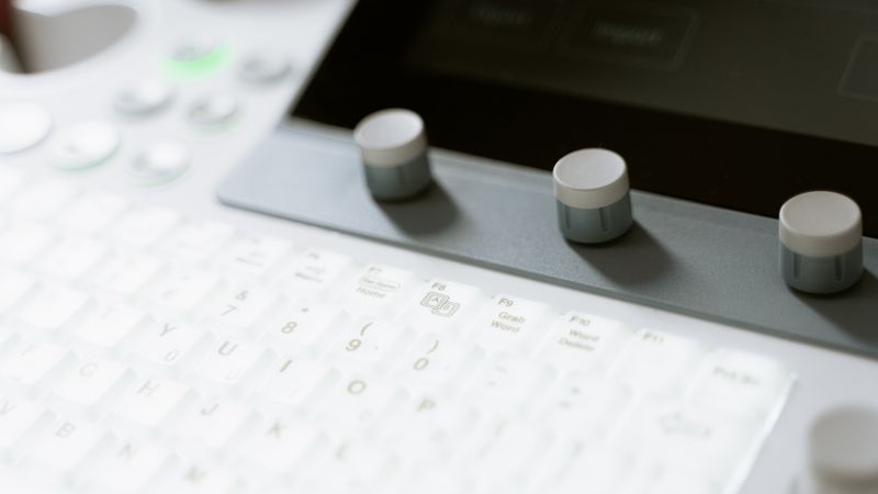 Detailed view of ultrasound machine showing keyboard and control knobs in a medical setting.