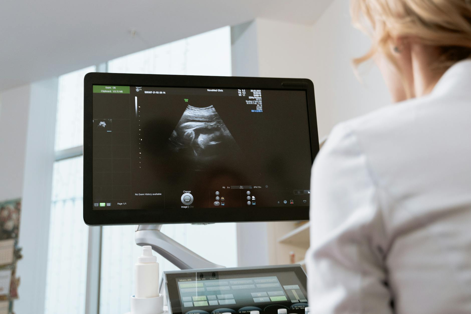 Photo Of An OB-GYN Looking In The Monitor