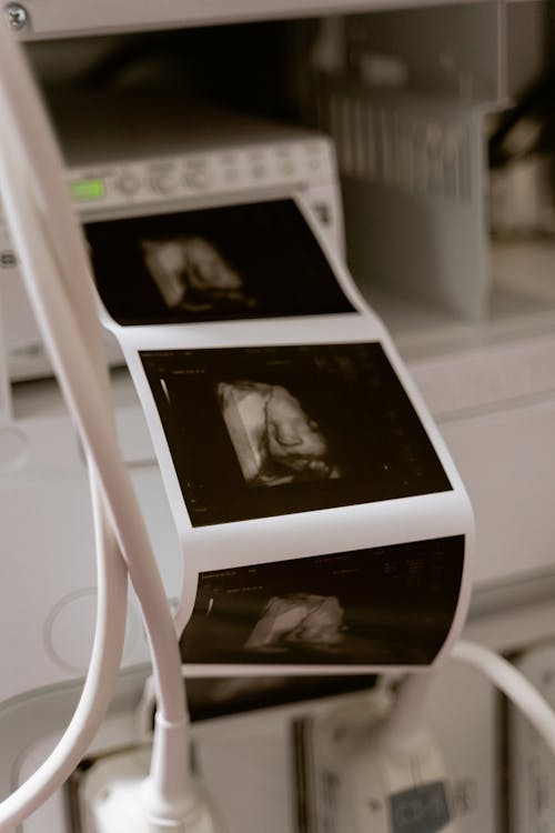 Ilmainen kuvapankkikuva tunnisteilla 3d-skannaus, 3d-ultraääni, anatomia