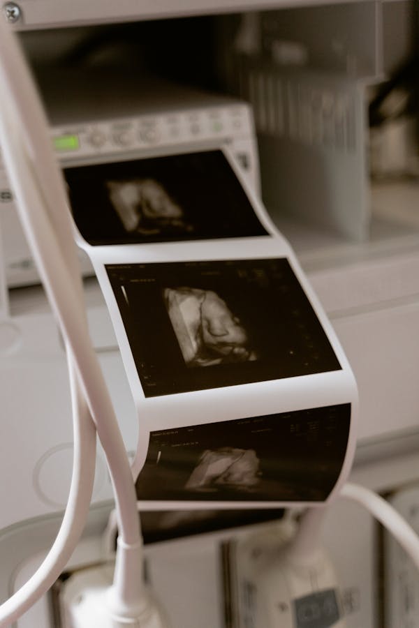 Free stock photo of 3d scanning, 3d ultrasound, anatomy