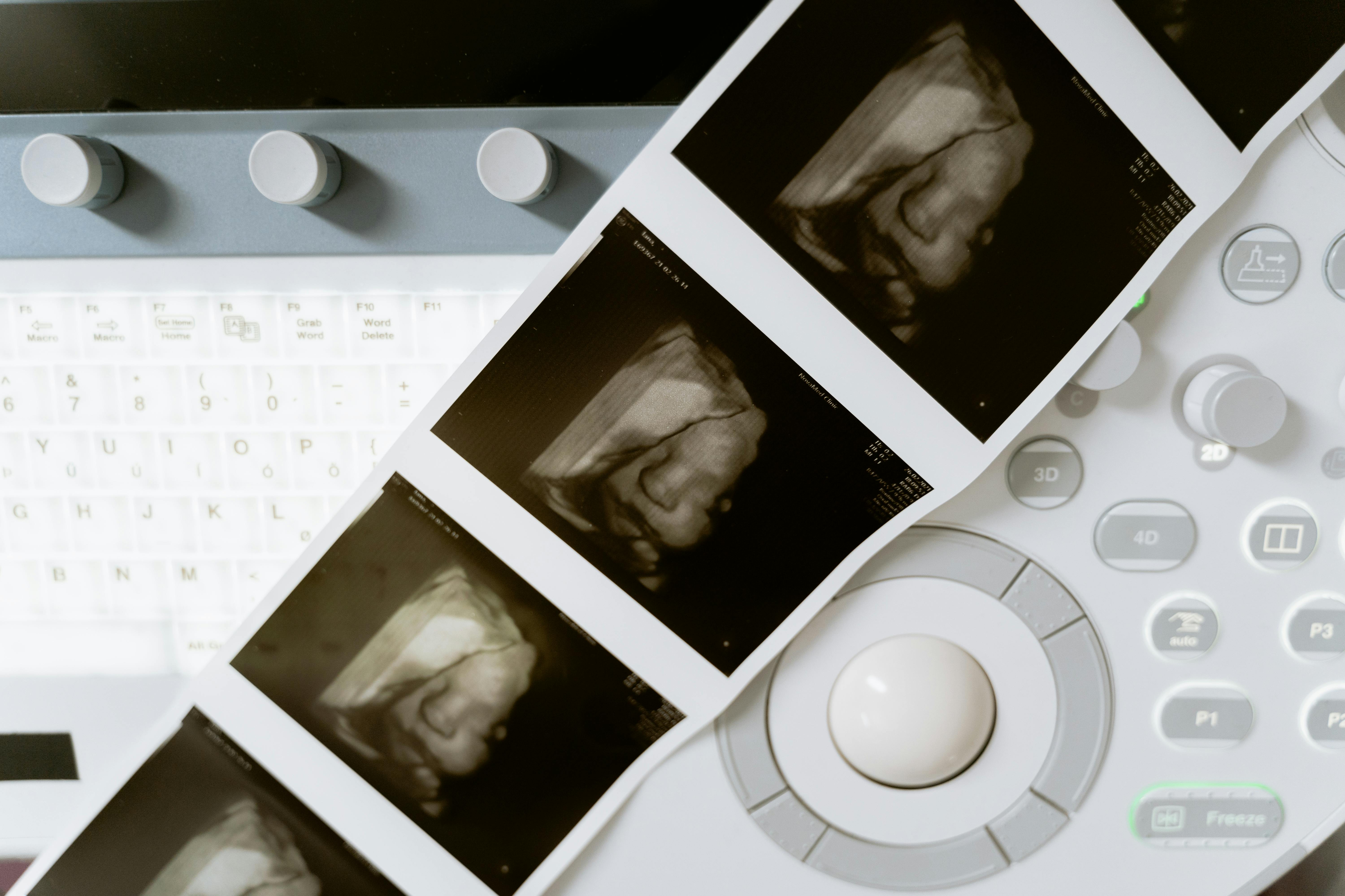 Elective ultrasound training in Georgia — a sonographer working with a client in a warm studio setting