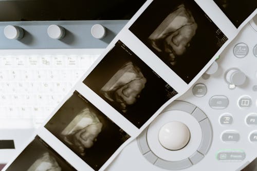 Free stock photo of 3d scanning, 3d ultrasound, anticipation