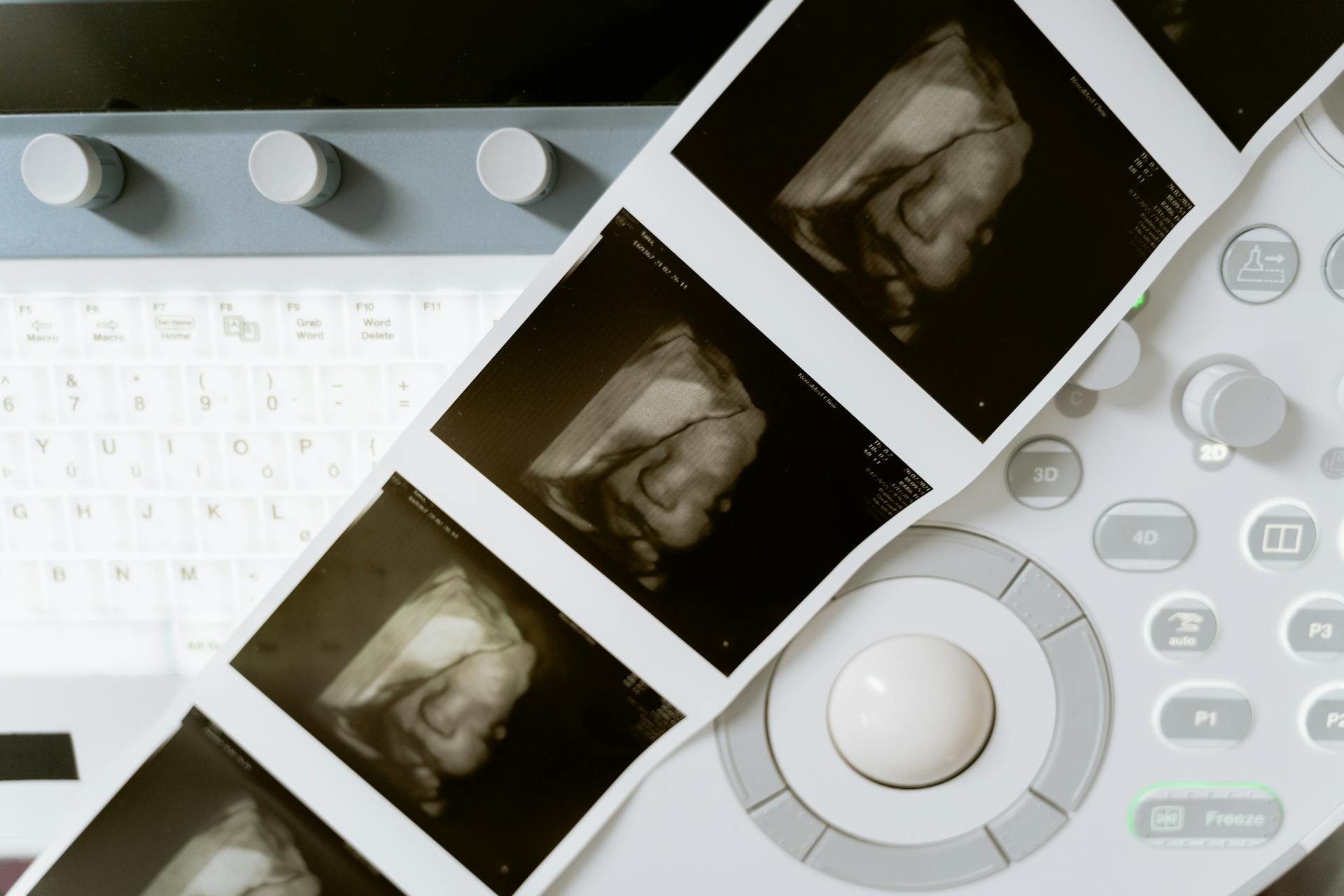 Free stock photo of 3d scanning, 3d ultrasound, antenatal care