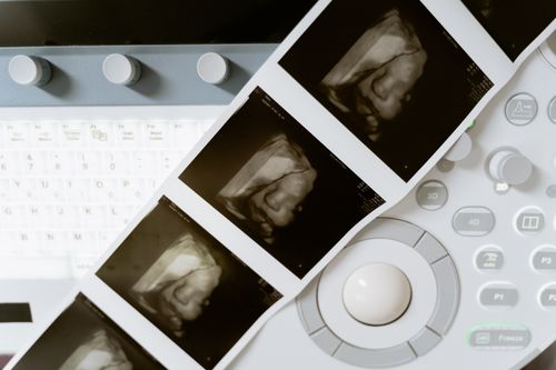 Free Close-up of a 3D ultrasound scan printout and medical equipment in a health lab. Stock Photo