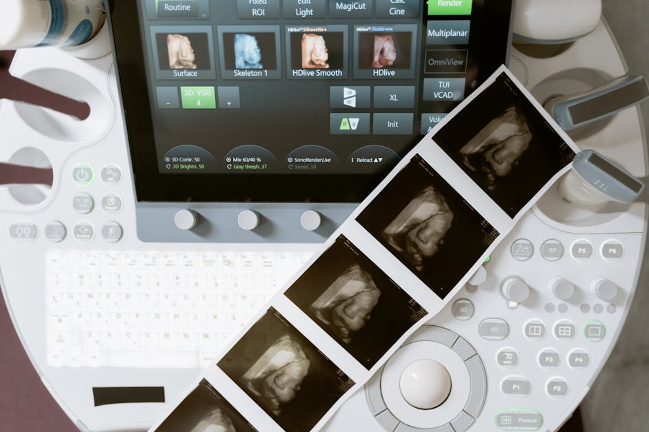 Ultrasound scan