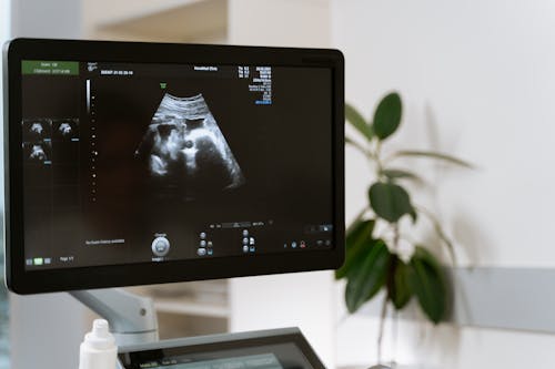 Free Photo Of Ultrasound Testing Stock Photo