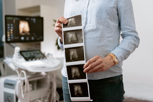 Photo Of Woman Holding The Printed Image Of Her Baby