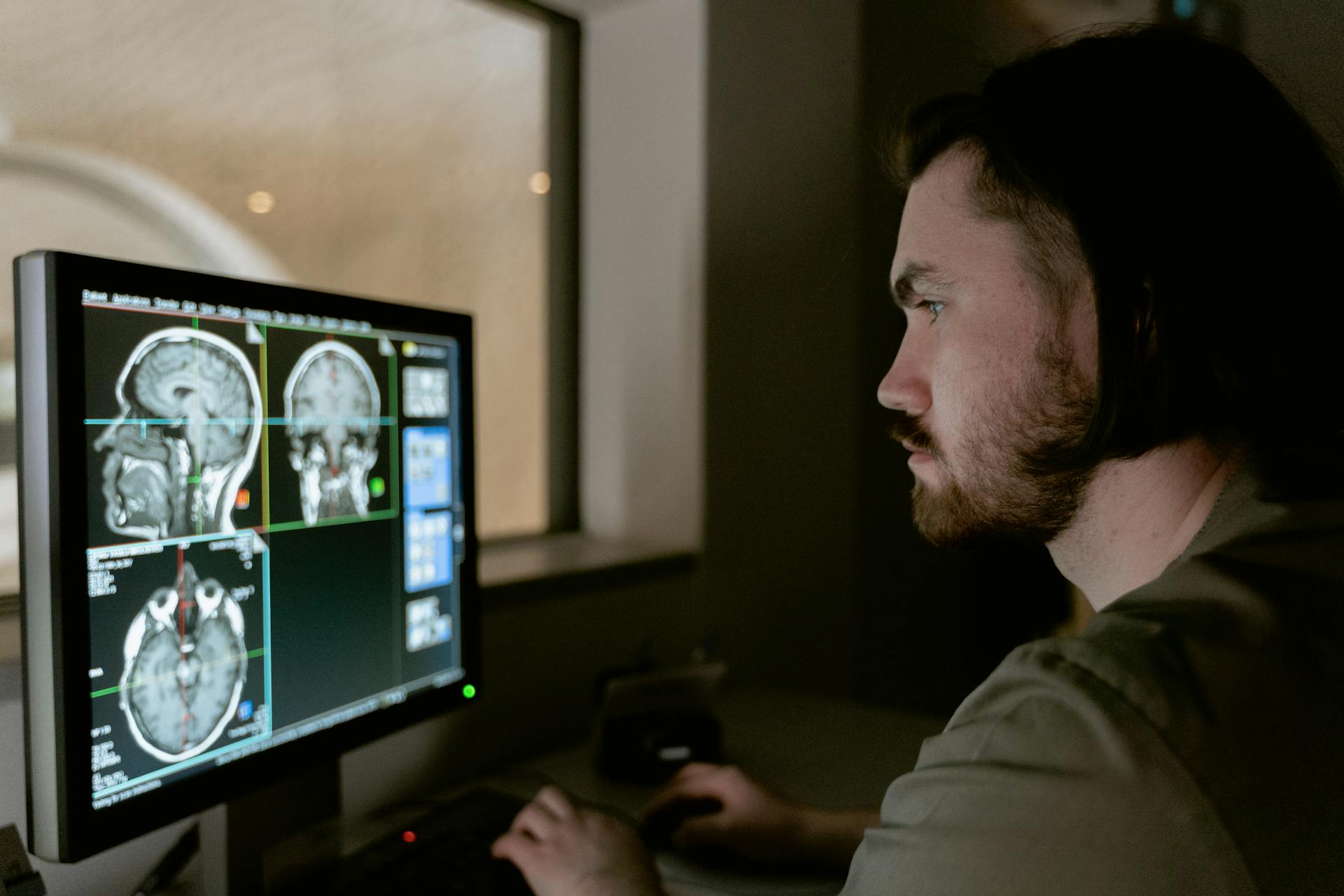 Free stock photo of analysis, assessment, brain scan