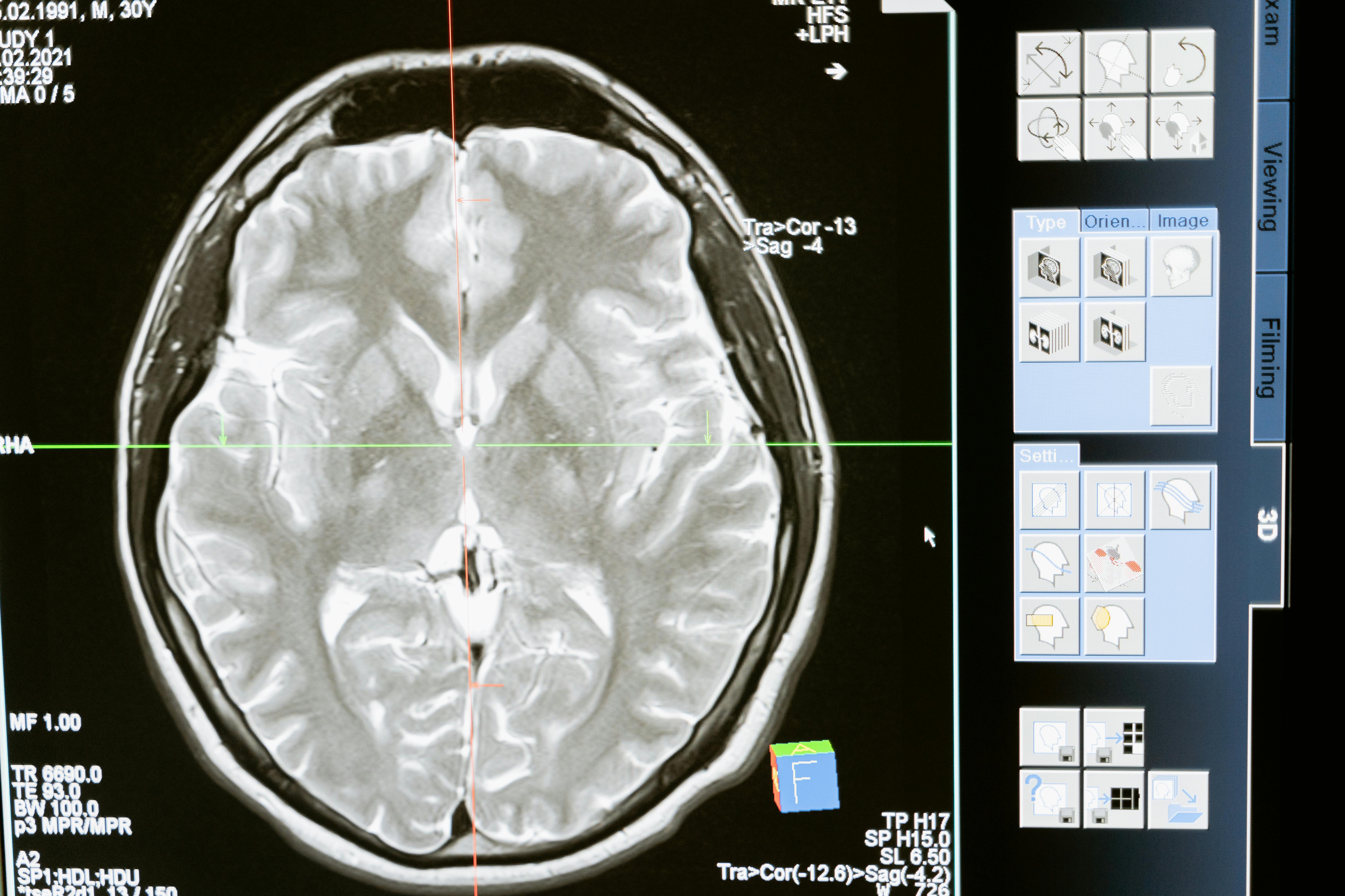  Mindful Brain: How Meditation Supports Cognitive Function