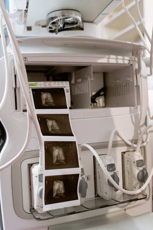 Gratis arkivbilde med 3d ultralyd, 3d-skanning, anatomi