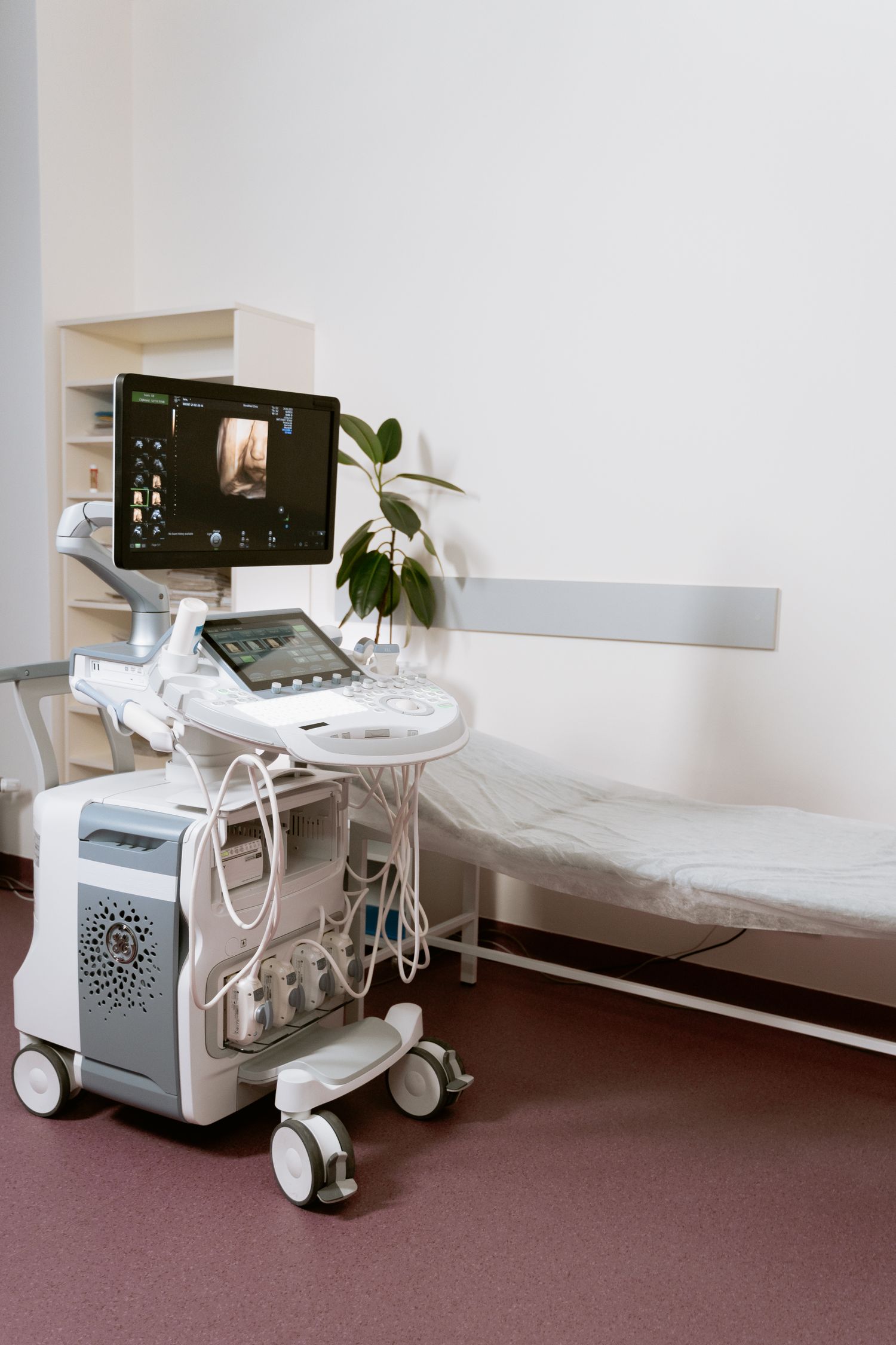 Appareil d'imagerie médicale utilisé pour l'exploration vasculaire