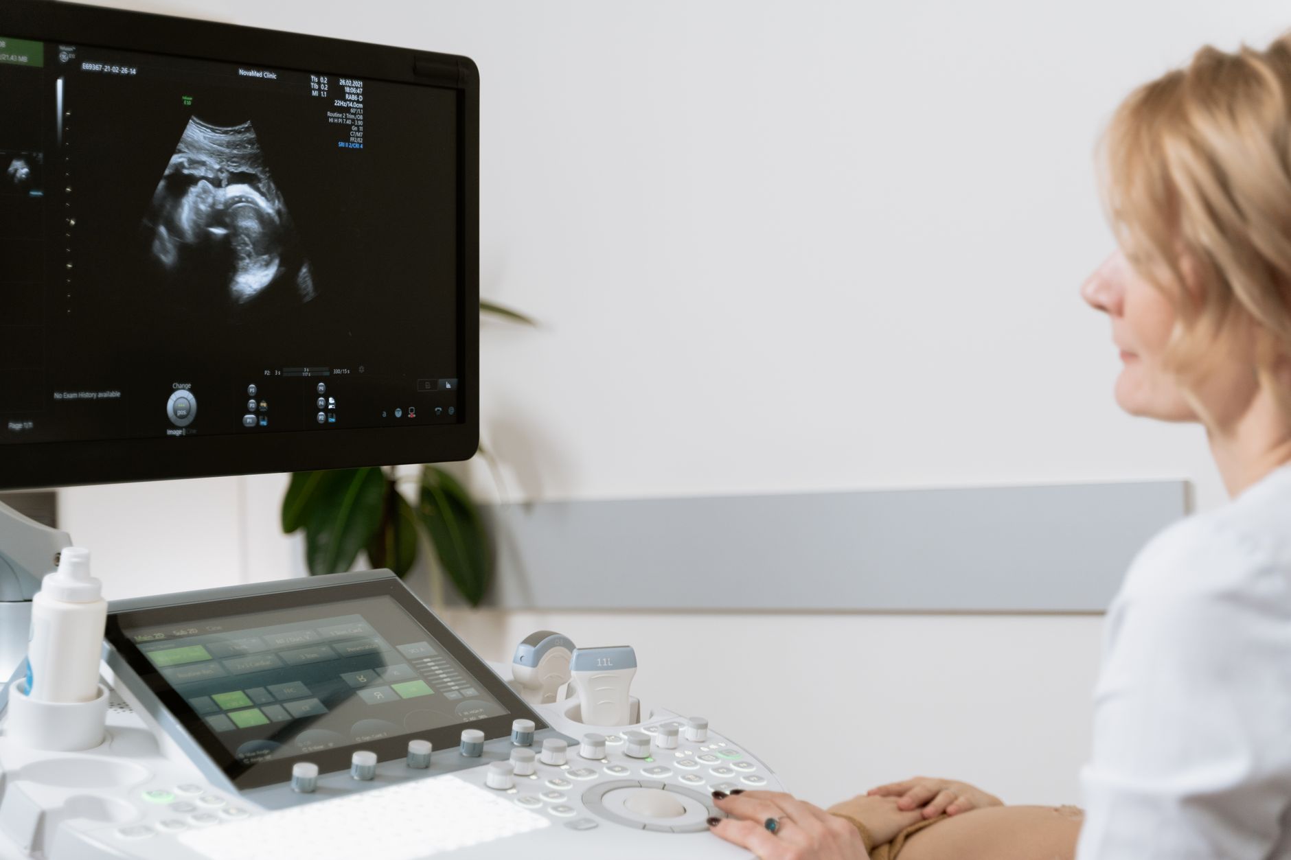 How AI Learned to Read X-Rays: The Real Science Behind Medical Image Diagnosis