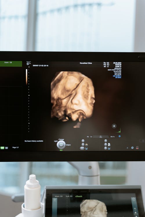 Free stock photo of 3d scanning, 3d ultrasound, analysis Stock Photo