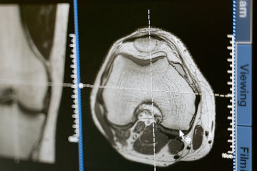 Foto profissional grátis de ' imagem digital ', análise, anatomia