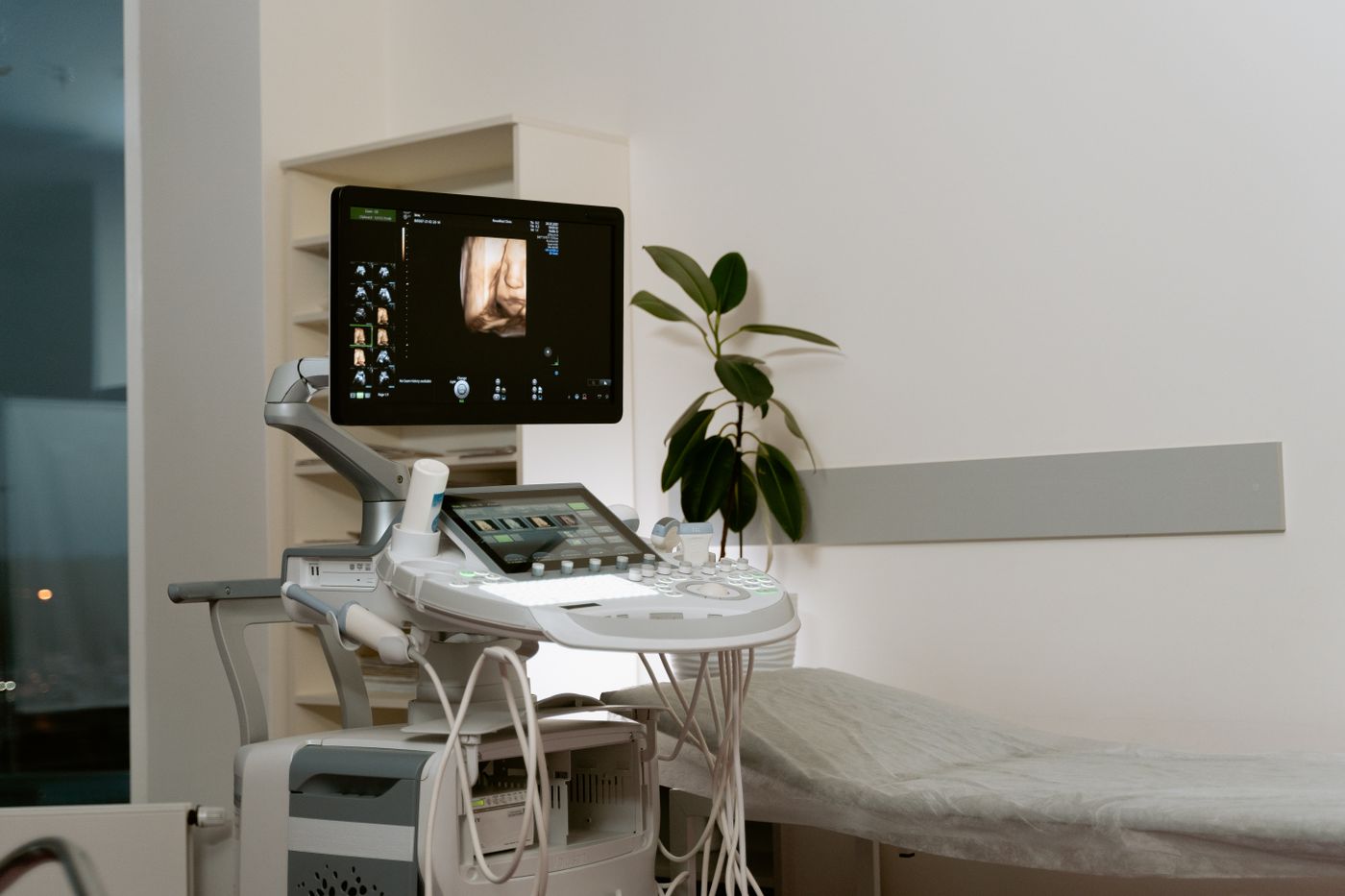 Equipo de ultrasonido médico en una sala de evaluación luminosa
