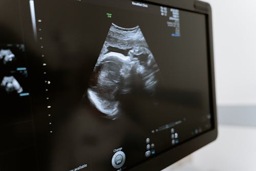 Základová fotografie zdarma na téma 3d skenování, 3d ultrazvuk, analýza