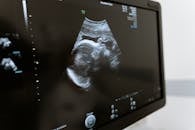 Free stock photo of 3d scanning, 3d ultrasound, analysis