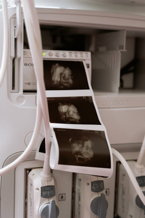 Free stock photo of 3d scanning, 3d ultrasound, anatomy
