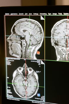 Free stock photo of 3d scanning, 3d ultrasound, analysis