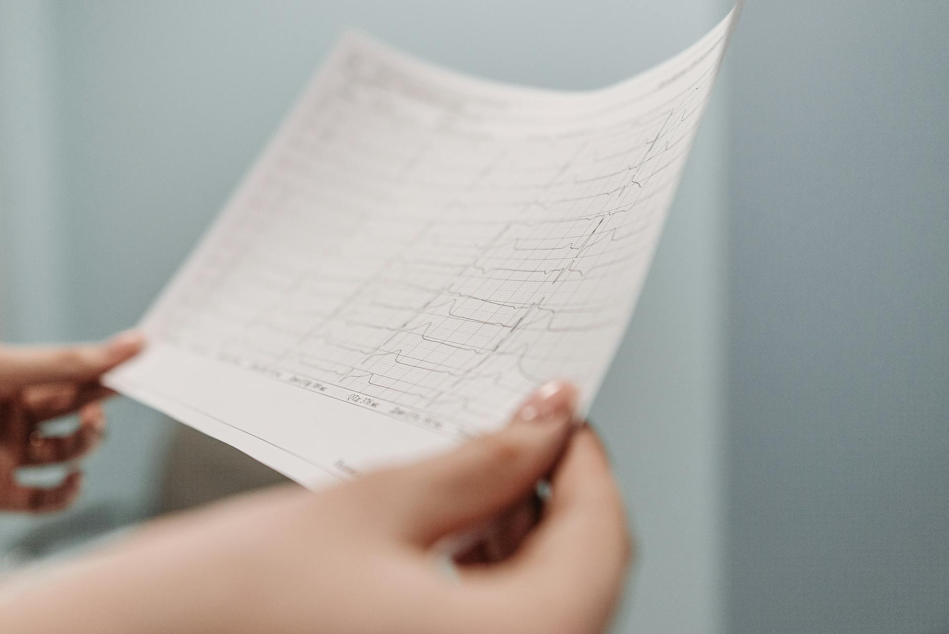 Close-up Shot of a Person Holding a Electrocardiogram Result